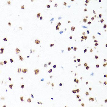 Immunohistochemistry - H1F0 Polyclonal Antibody (144-03298)