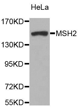 Western blot - MSH2 Polyclonal Antibody (144-01121)