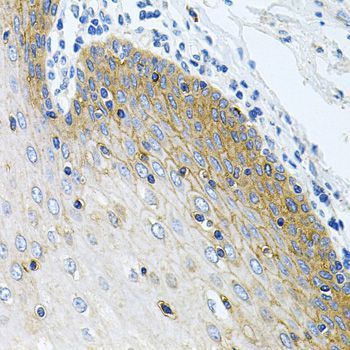 Immunohistochemistry - GNE Polyclonal Antibody (144-08570)