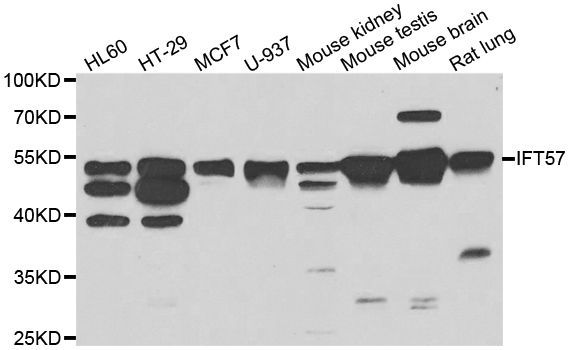 Western blot - IFT57 Polyclonal Antibody (144-07191)