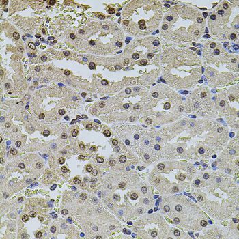 Immunohistochemistry - POT1 antibody (144-01491)