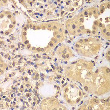 Immunohistochemistry - ARNT2 antibody (144-08060)