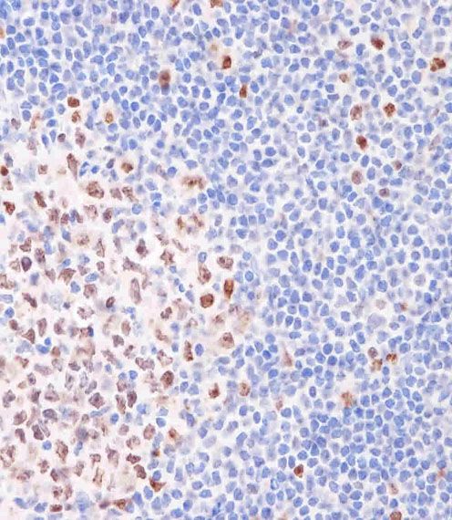 IHC