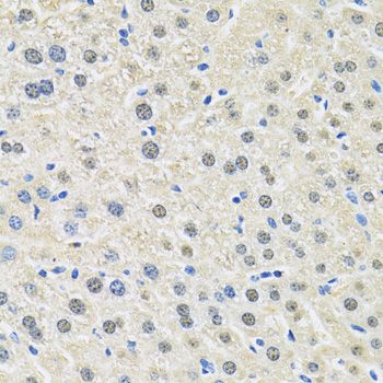 Immunohistochemistry - SLC3A2 antibody (144-05702)