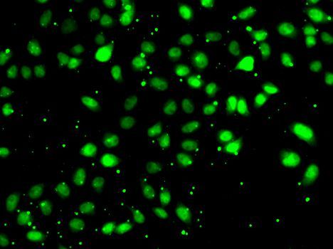 Immunofluorescence - NUDT2 Polyclonal Antibody (144-06868)