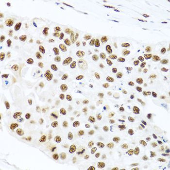 Immunohistochemistry - PRPF19 Polyclonal Antibody (144-12590)