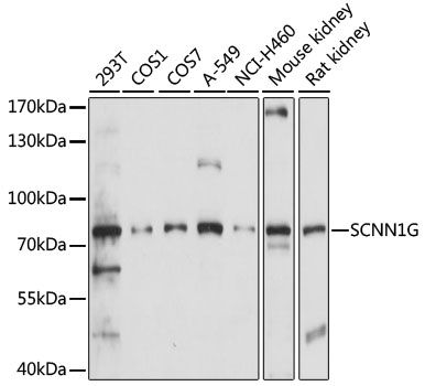Western blot - SCNN1G antibody (144-60913)