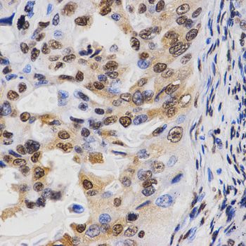 Immunohistochemistry - TriMethyl-Histone H3-K36 pAb (144-02366)