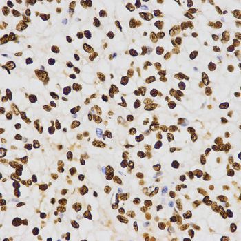 Immunohistochemistry - DiMethyl-Histone H3-K27 pAb (144-02362)