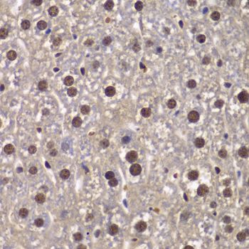 Immunohistochemistry - SMARCB1 Polyclonal Antibody (144-05767)