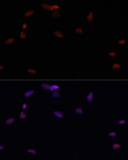 Immunohistochemistry - PARP1 Polyclonal Antibody (144-00942)