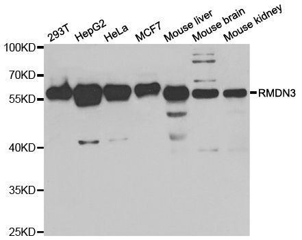Western blot - RMDN3 Polyclonal Antibody (144-05820)