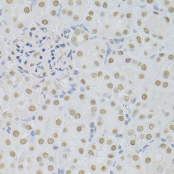 Immunohistochemistry - SFN Polyclonal Antibody (144-01026)