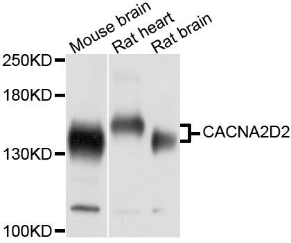 Western blot - CACNA2D2 Polyclonal Antibody (144-010267)