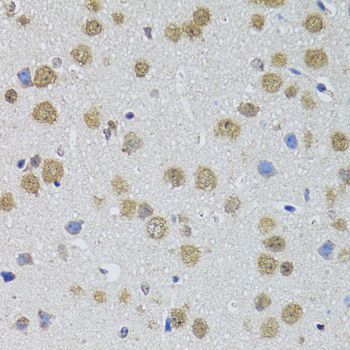 Immunohistochemistry - DMAP1 antibody (144-02324)