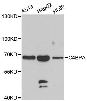 Western blot - C4BPA Polyclonal Antibody (144-07648)