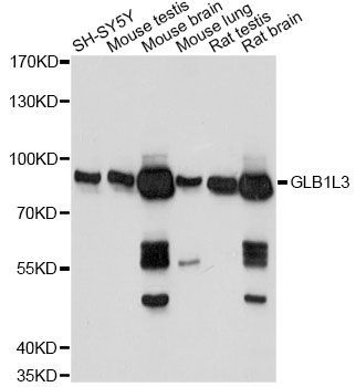 Western blot - GLB1L3 antibody (144-014953)