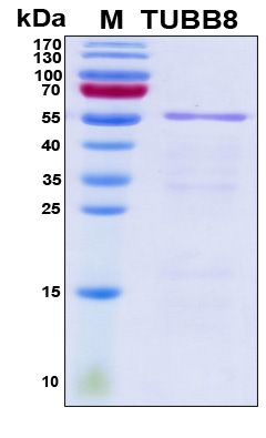 SDS-PAGE