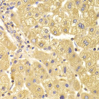 Immunohistochemistry - TRAF3IP2 Antibody (144-06776)