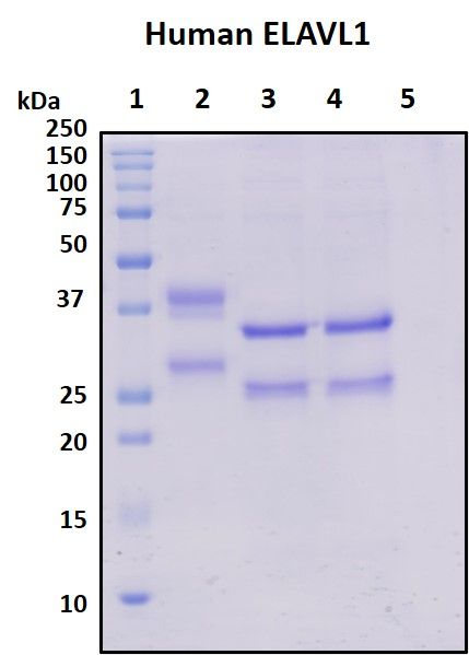 SDS-PAGE
