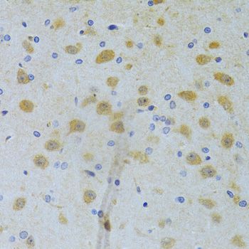 Immunohistochemistry - CHIA Antibody (144-06558)