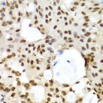 Immunohistochemistry - LIG3 antibody (144-60365)