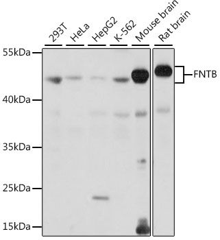 Western blot - FNTB antibody (144-015671)