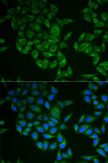 Immunofluorescence - CD247 antibody (144-02058)