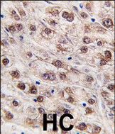 IHC-P