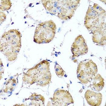 Immunohistochemistry - STK3 Polyclonal Antibody (144-06992)