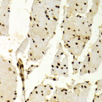 Immunohistochemistry - KPNA4 Antibody (144-02026)