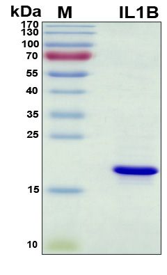 SDS-PAGE