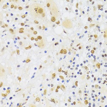 Immunohistochemistry - HNRNPA1 Polyclonal Antibody (144-07491)