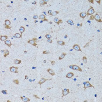 Immunohistochemistry - RARS antibody (144-06307)