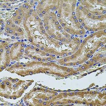 Immunohistochemistry - PDCD6IP antibody (144-02215)