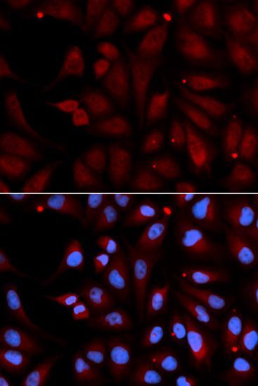 Immunofluorescence - MAOB antibody (144-01568)