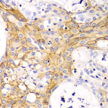 Immunohistochemistry - ACTA2 Polyclonal Antibody (144-60050)