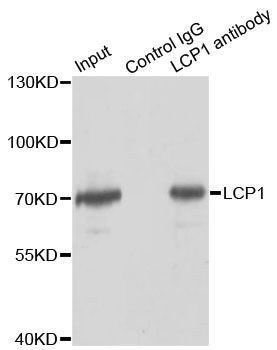 Immunoprecipitation - 3ug LCP1 antibody (144-05561)