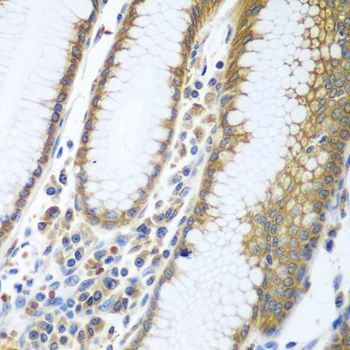 Immunohistochemistry - FUT6 antibody (144-03868)