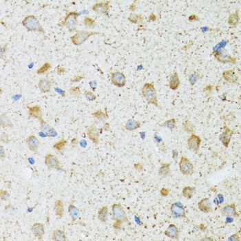 Immunohistochemistry - COG2 antibody (144-06251)