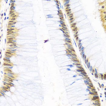 Immunohistochemistry - SKIV2L2 antibody (144-05576)