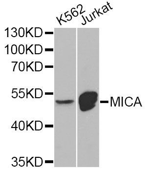 Western blot - MICA Antibody (144-600842)