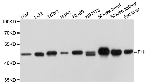 Western blot - FH Polyclonal Antibody (144-05688)