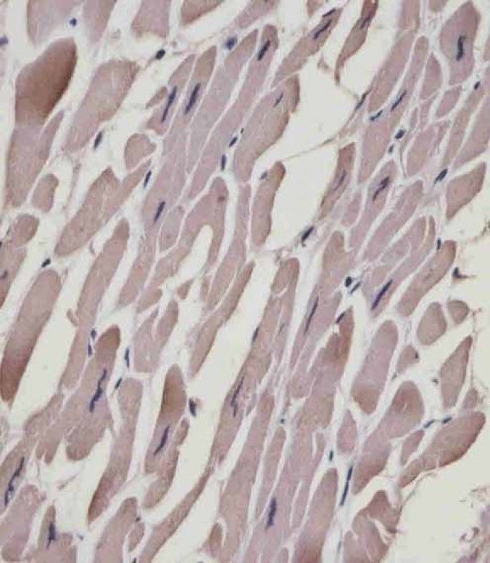 IHC-P