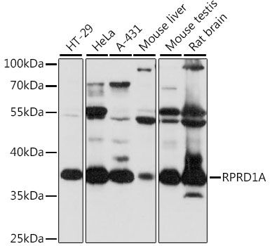 Western blot - RPRD1A antibody (144-015854)