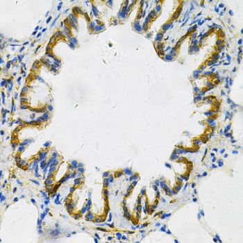 Immunohistochemistry - AK1 Polyclonal Antibody (144-603440)