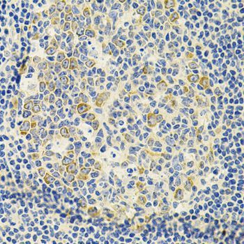 Immunohistochemistry - DDX20 Antibody (144-05817)
