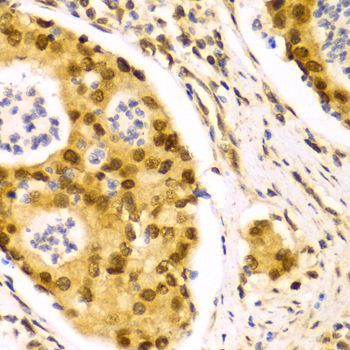 Immunohistochemistry - ELAVL1 Polyclonal Antibody (144-01608)