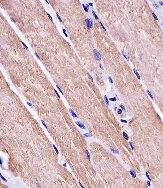 IHC-P