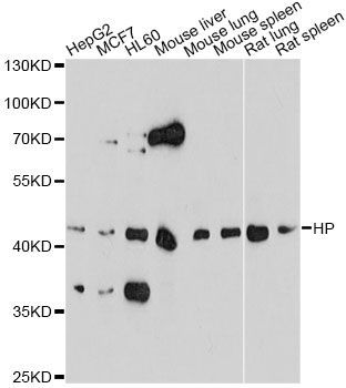 Western blot - HP antibody (144-01571)